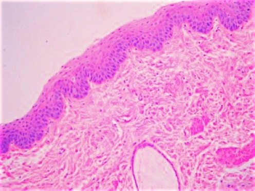 stratified squamous epithelium non keratinized esophagus