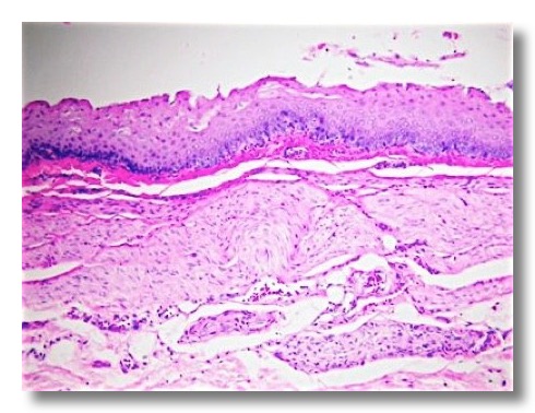 stratified squamous nonkeratinized epithelium esophagus